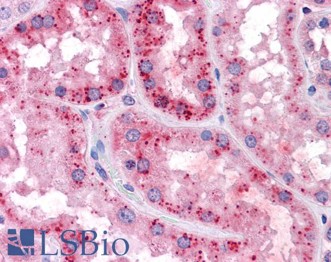 Anti-SLC7A11 antibody IHC of human kidney. Immunohistochemistry of formalin-fixed, paraffin-embedded tissue after heat-induced antigen retrieval. Antibody LS-B4345 concentration 3.75 ug/ml.