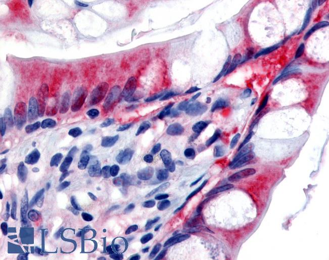 Anti-SLC7A11 antibody IHC of human small intestine. Immunohistochemistry of formalin-fixed, paraffin-embedded tissue after heat-induced antigen retrieval. Antibody LS-B518 concentration 5 ug/ml.
