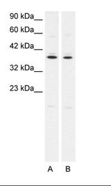 A. Jurkat Cell Lysate B. HepG2 Cell Lysate