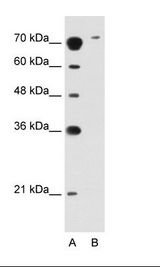 A: Marker, B: Jurkat Cell Lysate