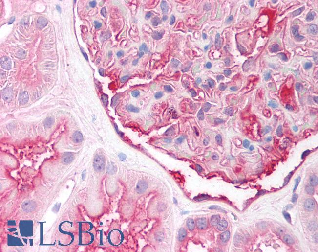 Anti-SLC7A2 antibody IHC of human kidney. Immunohistochemistry of formalin-fixed, paraffin-embedded tissue after heat-induced antigen retrieval. Antibody LS-B901 concentration 10 ug/ml.