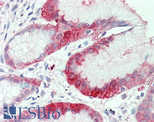 Anti-SLC7A2 antibody LS-A9309 IHC of human stomach. Immunohistochemistry of formalin-fixed, paraffin-embedded tissue after heat-induced antigen retrieval.