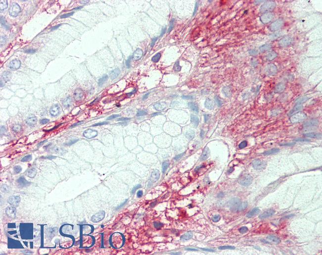 Anti-SLC7A2 antibody LS-A9306 IHC of human stomach. Immunohistochemistry of formalin-fixed, paraffin-embedded tissue after heat-induced antigen retrieval.
