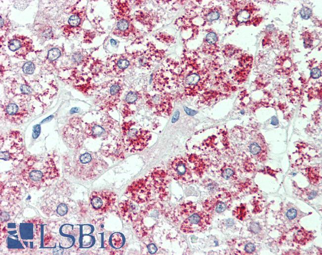 Anti-SLC7A2 antibody LS-A9306 IHC of human adrenal. Immunohistochemistry of formalin-fixed, paraffin-embedded tissue after heat-induced antigen retrieval.