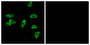 Immunofluorescence of LOVO cells, using PTGER3 Antibody. The picture on the right is treated with the synthesized peptide.