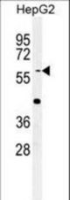 Western blot of YLAT2 Antibody in HepG2 cell line lysates (35 ug/lane). YLAT2 (arrow) was detected using the purified antibody.