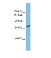 Western blot of Human ACHN. SLC8A1 antibody dilution 1.0 ug/ml.