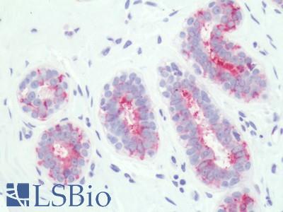 Human, Breast: Formalin-Fixed Paraffin-Embedded (FFPE)