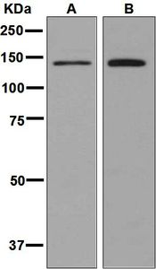 Western blot analysis on (A) Molt-4 and (B) Caco-2 cell lysates using anti-SLC9A1 antibody.