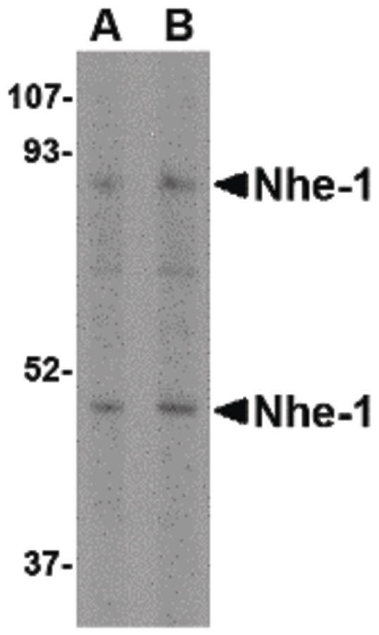 Western blot of Nhe-1 in rat kidney tissue lysate with in with Nhe-1 antibody at (A) 1 and (B) 2 ug/ml.