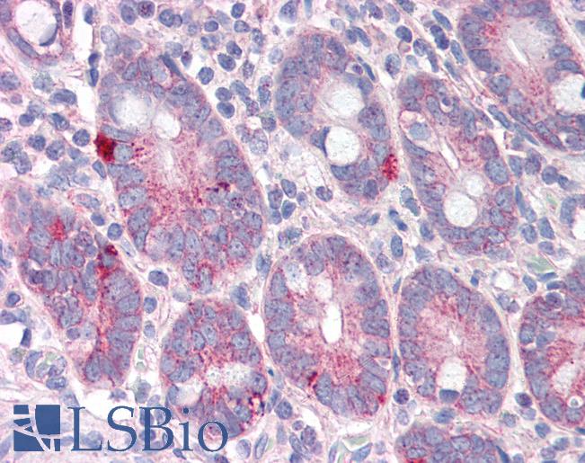 Anti-SLC9A1 antibody IHC of human small intestine. Immunohistochemistry of formalin-fixed, paraffin-embedded tissue after heat-induced antigen retrieval. Antibody LS-B2696 concentration 5 ug/ml.