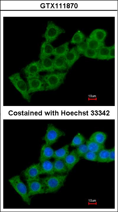 Immunofluorescence of methanol-fixed HepG2 using Calcium binding protein P22 antibody at 1:200 dilution.