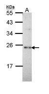 Sample (30 ug of whole cell lysate). A: Hep G2 . 12% SDS PAGE. SLC9A1BP / CHP antibody diluted at 1:1000.