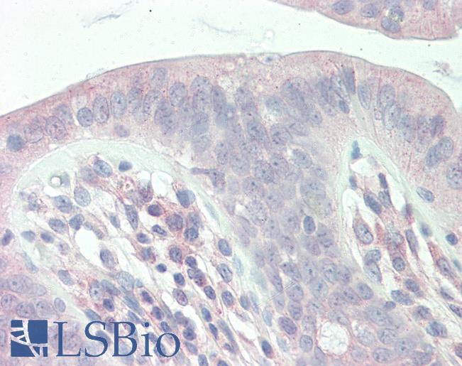 Anti-SLC9A1BP / CHP antibody IHC staining of human colon. Immunohistochemistry of formalin-fixed, paraffin-embedded tissue after heat-induced antigen retrieval. Antibody LS-B10321 concentration 10 ug/ml.