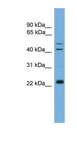 CHP antibody Western blot of 721_B cell lysate.