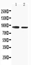 WB of SLC9A2 / NHE2 antibody. Lane 1: Rat Skeletal Musle Tissue Lysate. Lane 2: Rat Kidney Tissue Lysate.