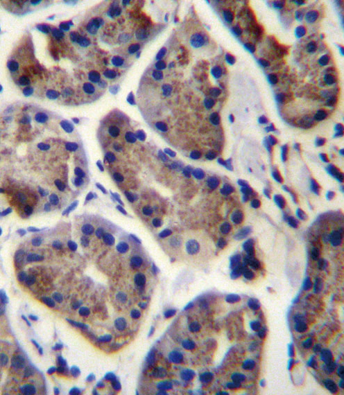 SLC9A2 Antibody immunohistochemistry of formalin-fixed and paraffin-embedded human stomach tissue followed by peroxidase-conjugated secondary antibody and DAB staining.
