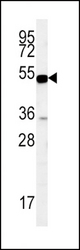 SLC9A3R1 Antibody western blot of MDA-MB435 cell line lysates (35 ug/lane). The SLC9A3R1 antibody detected the SLC9A3R1 protein (arrow).