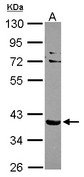 Sample (30 ug of whole cell lysate). A: NT2D1. 10% SDS PAGE. SLC9A3R2 / SIP-1 antibody diluted at 1:1000.