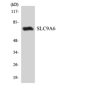 Western blot of the lysates from COLO205 cells using SLC9A6 antibody.