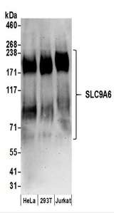 Detection of Human SLC9A6 by Western Blot. Samples: Whole cell lysate (50 ug) prepared using NETN buffer from HeLa, 293T, and Jurkat cells. Antibodies: Affinity purified rabbit anti-SLC9A6 antibody used for WB at 0.1 ug/ml. Detection: Chemiluminescence with an exposure time of 3 minutes.