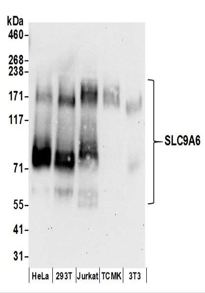 Detection of Human and Mouse SLC9A6 by Western Blot. Samples: Whole cell lysate (50 ug) prepared using NETN buffer from HeLa, 293T, Jurkat, mouse TCMK-1, and mouse NIH3T3 cells. Antibodies: Affinity purified rabbit anti-SLC9A6 antibody used for WB at 0.1 ug/ml. Detection: Chemiluminescence with an exposure time of 30 seconds.