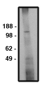 Western blot of NHE6 antibody (LS-C140602) on human brain lysate (15 ug/lane). Antibody used at 10 ug/ml. Secondary antibody, mouse anti-rabbit, used at 1:150K dilution.