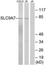 Western blot of extracts from Jurkat/COLO cells, using SLC9A7 Antibody. The lane on the right is treated with the synthesized peptide.