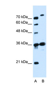 SLC9A7 antibody LS-C40446 Western blot of Jurkat lysate.