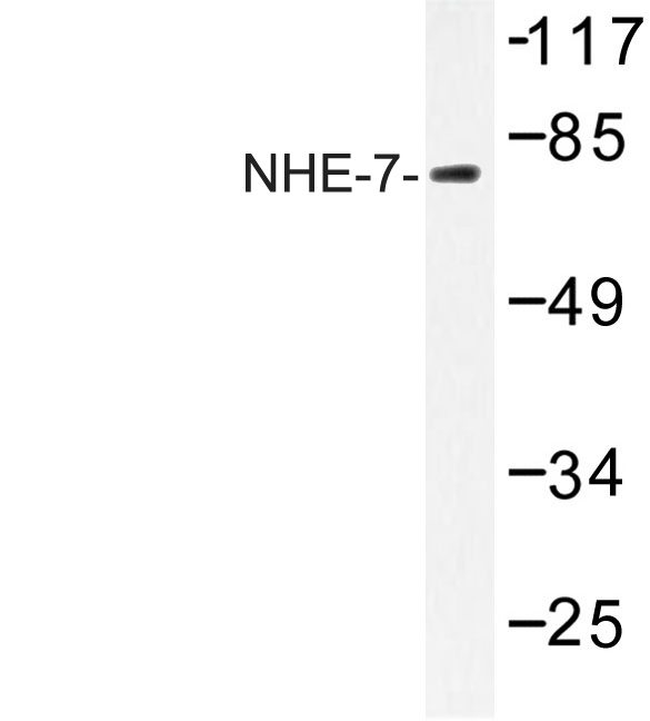 Western blot of NHE-7 (D566) pAb in extracts from COLO cells.