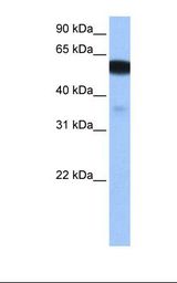 Fetal brain cell lysate. Antibody concentration: 0.5 ug/ml. Gel concentration: 12%.