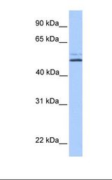 NTERA2 cell lysate. Antibody concentration: 1.0 ug/ml. Gel concentration: 12%.