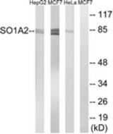 Western blot of extracts from HeLa/MCF-7/HepG2 cells, using SLCO1A2 Antibody. The lane on the right is treated with the synthesized peptide.