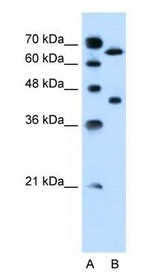 Lane A: Marker Lane B: Jurkat Cell Lysate.