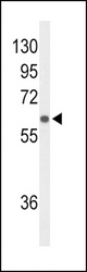 Western blot of SLCO1B1 Antibody in HepG2 cell line lysates (35 ug/lane). SLCO1B1 (arrow) was detected using the purified antibody.