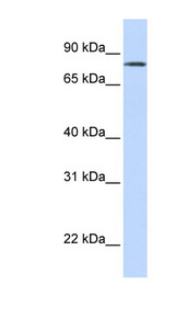LST-3TM12 antibody LS-C110963 Western blot of Fetal Lung lysate.