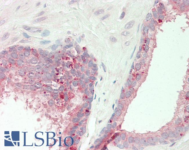 Human Prostate: Formalin-Fixed, Paraffin-Embedded (FFPE)