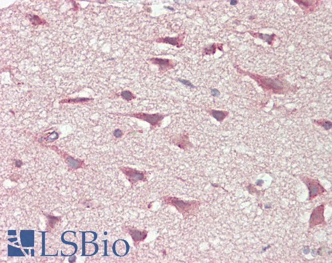 Anti-SLCO6A1 / OATP-I antibody IHC staining of human brain, cortex. Immunohistochemistry of formalin-fixed, paraffin-embedded tissue after heat-induced antigen retrieval. Antibody LS-B11324 dilution 1:100.