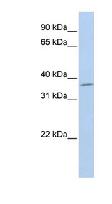 SLFNL1 antibody LS-C102469 Western blot of Jurkat lysate.