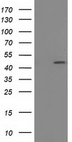 HEK293T cells were transfected with the pCMV6-ENTRY control (Left lane) or pCMV6-ENTRY SLFNL1 (Right lane) cDNA for 48 hrs and lysed. Equivalent amounts of cell lysates (5 ug per lane) were separated by SDS-PAGE and immunoblotted with anti-SLFNL1.