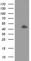HEK293T cells were transfected with the pCMV6-ENTRY control (Left lane) or pCMV6-ENTRY SLFNL1 (Right lane) cDNA for 48 hrs and lysed. Equivalent amounts of cell lysates (5 ug per lane) were separated by SDS-PAGE and immunoblotted with anti-SLFNL1.