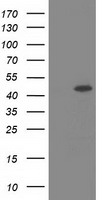 HEK293T cells were transfected with the pCMV6-ENTRY control (Left lane) or pCMV6-ENTRY SLFNL1 (Right lane) cDNA for 48 hrs and lysed. Equivalent amounts of cell lysates (5 ug per lane) were separated by SDS-PAGE and immunoblotted with anti-SLFNL1.