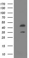 HEK293T cells were transfected with the pCMV6-ENTRY control (Left lane) or pCMV6-ENTRY SLFNL1 (Right lane) cDNA for 48 hrs and lysed. Equivalent amounts of cell lysates (5 ug per lane) were separated by SDS-PAGE and immunoblotted with anti-SLFNL1.
