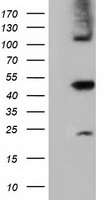 HEK293T cells were transfected with the pCMV6-ENTRY control (Left lane) or pCMV6-ENTRY SLFNL1 (Right lane) cDNA for 48 hrs and lysed. Equivalent amounts of cell lysates (5 ug per lane) were separated by SDS-PAGE and immunoblotted with anti-SLFNL1.