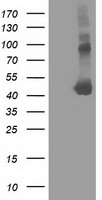 HEK293T cells were transfected with the pCMV6-ENTRY control (Left lane) or pCMV6-ENTRY SLFNL1 (Right lane) cDNA for 48 hrs and lysed. Equivalent amounts of cell lysates (5 ug per lane) were separated by SDS-PAGE and immunoblotted with anti-SLFNL1.