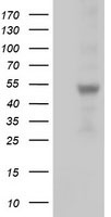 HEK293T cells were transfected with the pCMV6-ENTRY control (Left lane) or pCMV6-ENTRY SLFNL1 (Right lane) cDNA for 48 hrs and lysed. Equivalent amounts of cell lysates (5 ug per lane) were separated by SDS-PAGE and immunoblotted with anti-SLFNL1.