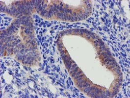 IHC of paraffin-embedded Human endometrium tissue using anti-SLFNL1 mouse monoclonal antibody.