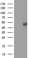 HEK293T cells were transfected with the pCMV6-ENTRY control (Left lane) or pCMV6-ENTRY SLFNL1 (Right lane) cDNA for 48 hrs and lysed. Equivalent amounts of cell lysates (5 ug per lane) were separated by SDS-PAGE and immunoblotted with anti-SLFNL1.