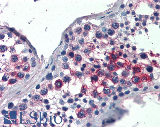 Anti-FHL1 antibody IHC of human testis. Immunohistochemistry of formalin-fixed, paraffin-embedded tissue after heat-induced antigen retrieval. Antibody LS-B2495 concentration 5 ug/ml.