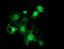 Anti-FHL1 mouse monoclonal antibody immunofluorescent staining of COS7 cells transiently transfected by pCMV6-ENTRY FHL1.